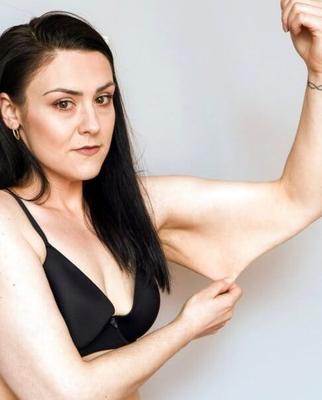 Saggy Weight Loss Skin - The Fetish You Never Knew You Had