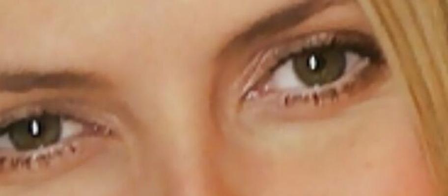 Eyes