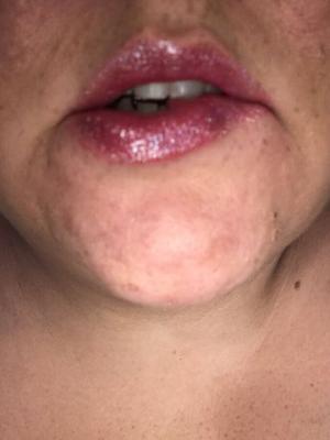 Juicy Lips