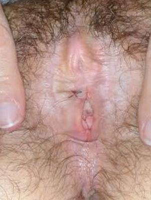Elderly atrophic vulva is yummy