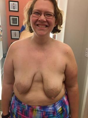 Saggy Tits