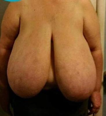 Biggest Monster macromastia