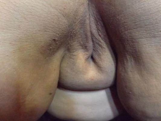 close up