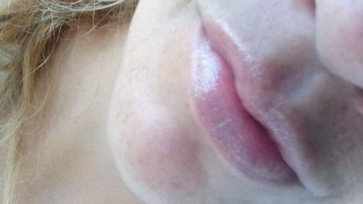 Tiger girlfriends lips