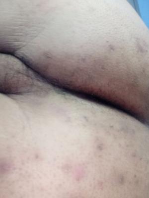 Cherche homme foug ans