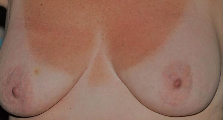 My wife's chest