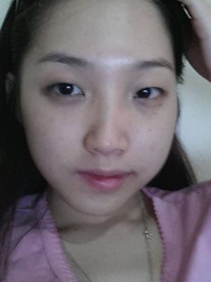 Vietnamese Amateur-