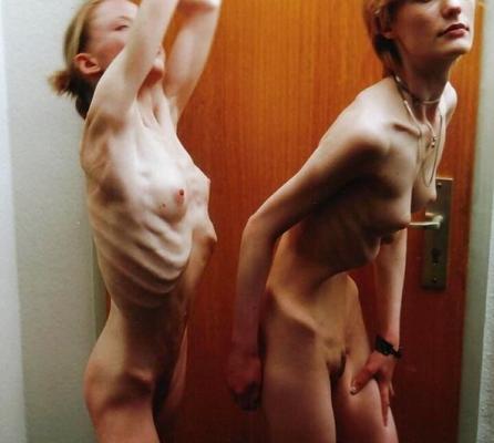 Anorexic-Cunts