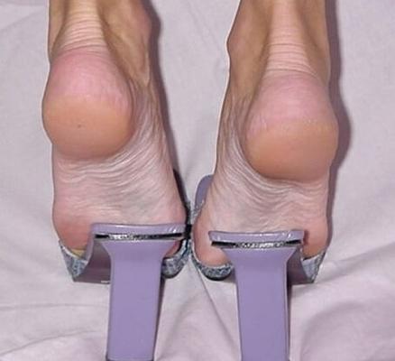 FEET _ sandali e zoccoli