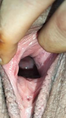 Cum covered cervix