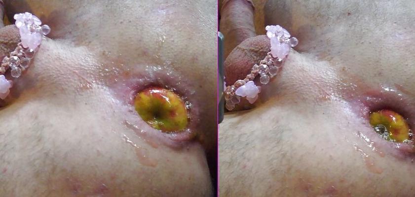 Insertions!