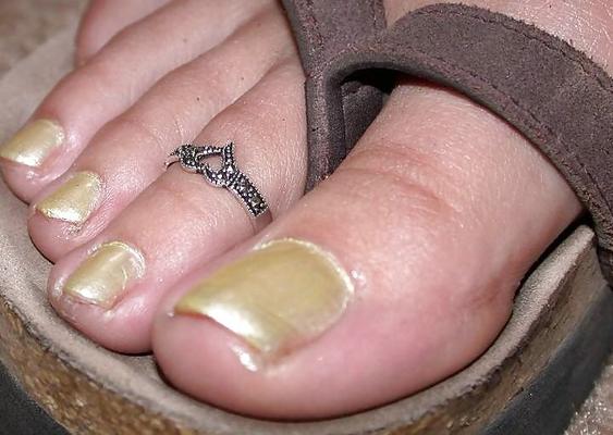My foot