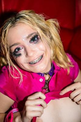Sexy women wearing braces