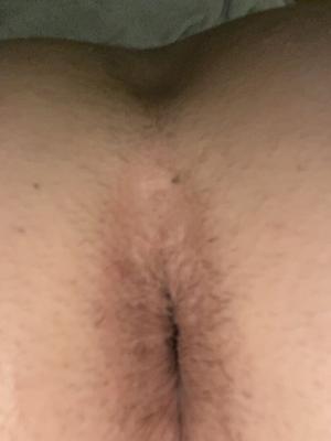 My gaped hole