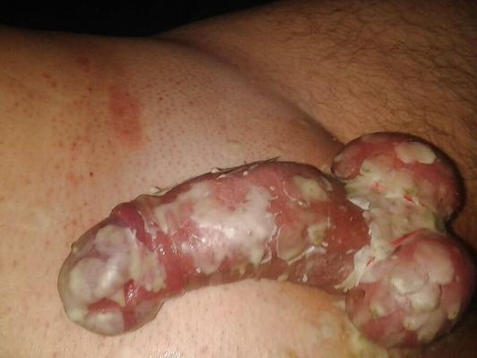 Esclave sexuelle