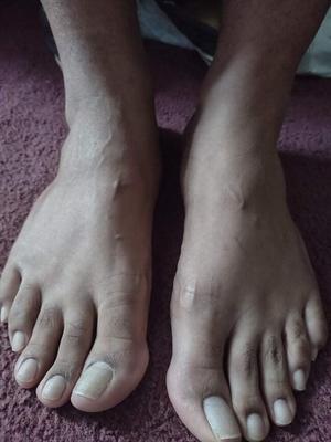 Mis increíbles pies de hombre