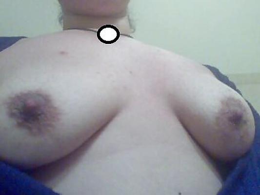 Saggy Tits Dark Areolas