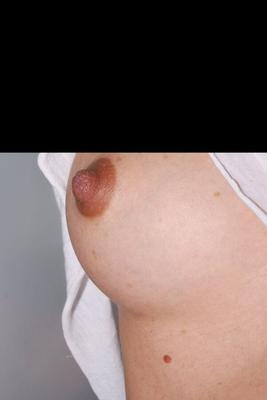 pregnant natural