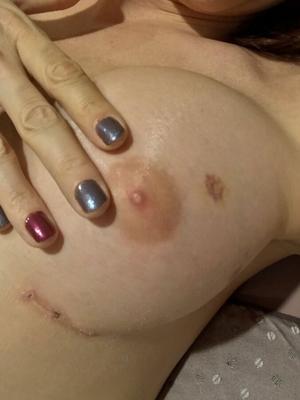 Mes nouveaux seins !!