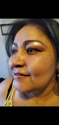 Esposa ELA ca