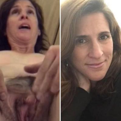 Before and after