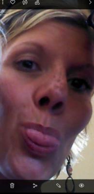 FRECKLED : My New Lips for Black Cocks