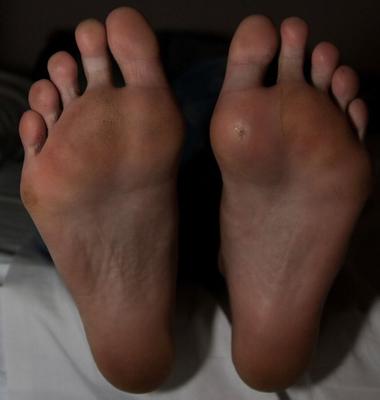 Dirty feet