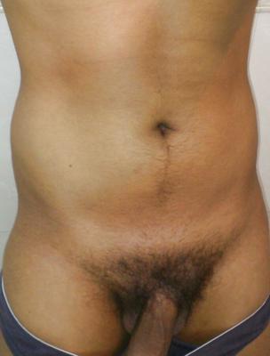 Just my dick