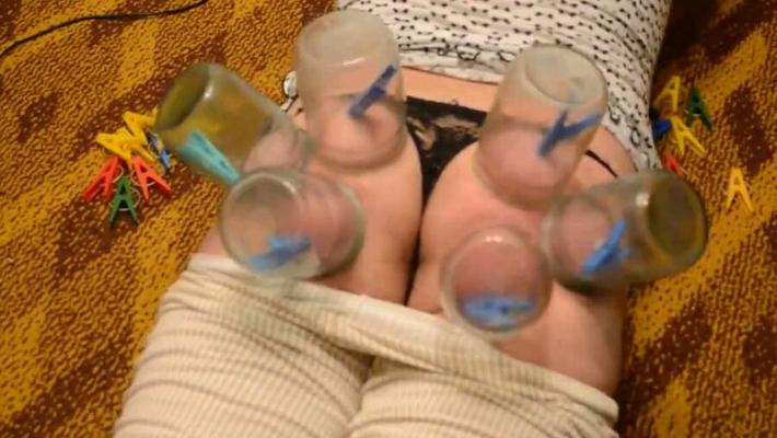 fire cupping for her