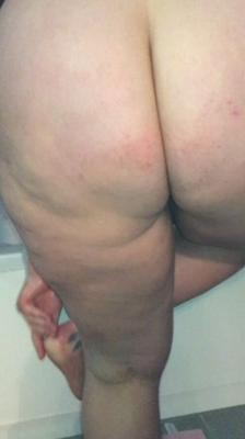 My Bum