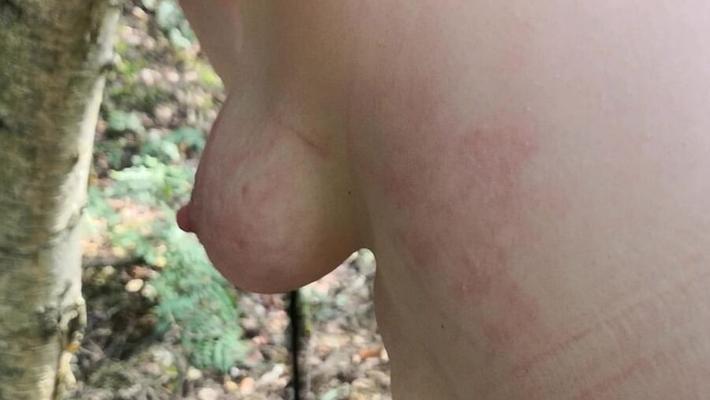 森の中で鞭打たれる裸のおっぱいとお尻
