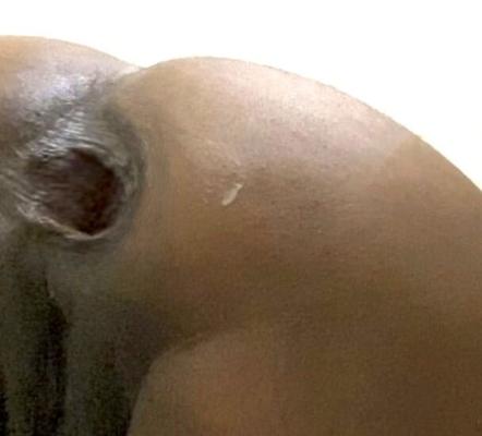 Ass prolapse