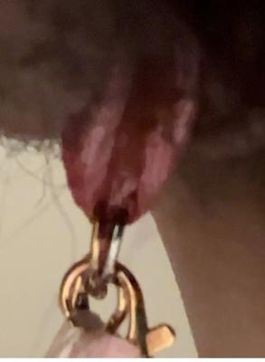 Stretched urethra - 5 Pics