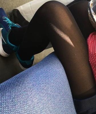 Legs