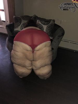 Nothing But Obese Legs