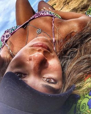 The freckles in the chest