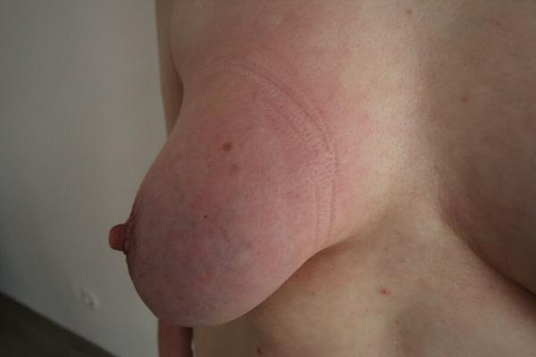 Ziptie my tits an watch them swollen