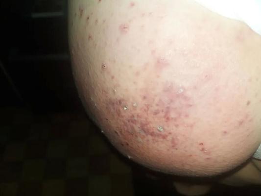 Spank me