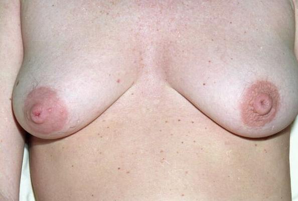 Hot inverted nips MILF I want to cum on