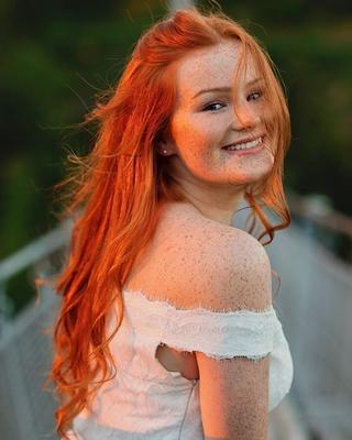 Freckled Beauty Victoria
