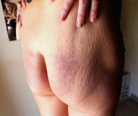 Cropped ass next morning - 5 Pics