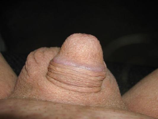 5P Petit pénis