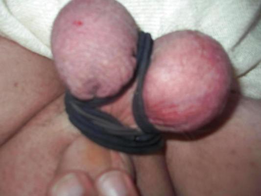 7P BOUND BALLS CBT