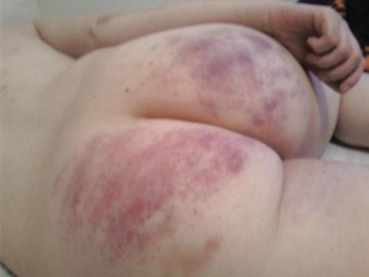 5P Fun with wax and a paddled ass.