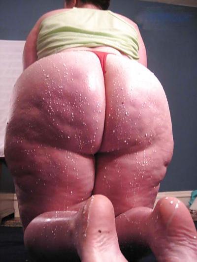25P Épais, blanc et cellulite 2