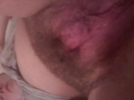 18P Hairy friend