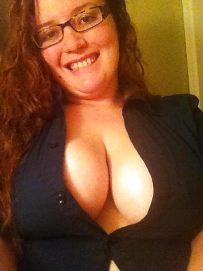 10P Cleavage 1