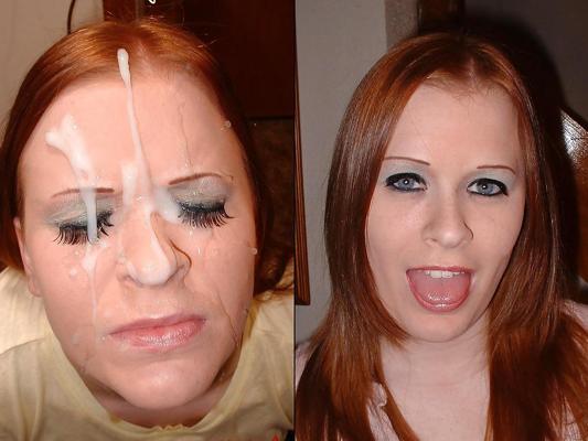 25P Before During and After Facials