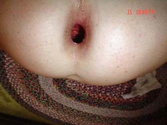 4P My gaping hole