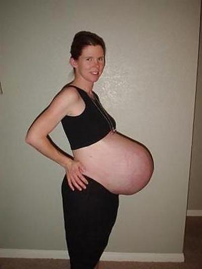 25P Pregnant 